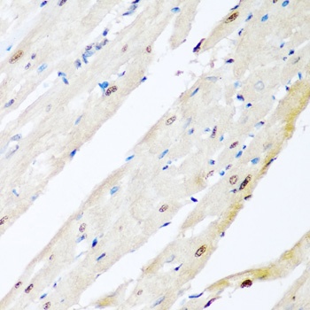 VCP Antibody