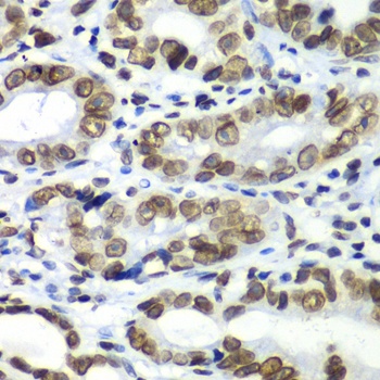 TEAD1 Antibody