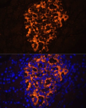 PNLIPRP2 Antibody