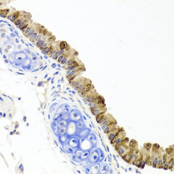 TOPBP1 Antibody