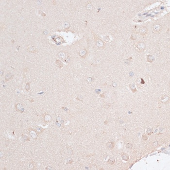 ABCF2 Antibody