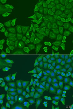 ABCF2 Antibody
