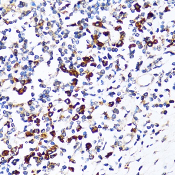 RPN1 Antibody