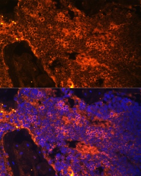 SPTA1 Antibody