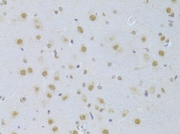 CDKN1A Antibody
