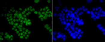 CTCF Antibody