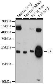 IL6 Antibody
