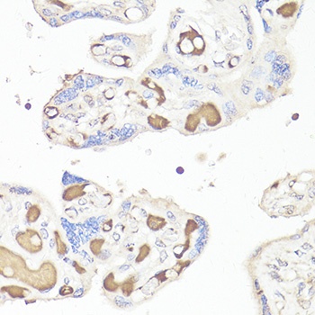 IL6 Antibody