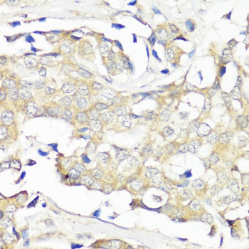 EIF3B Antibody