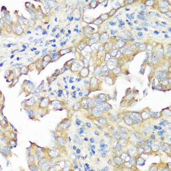 EIF3B Antibody
