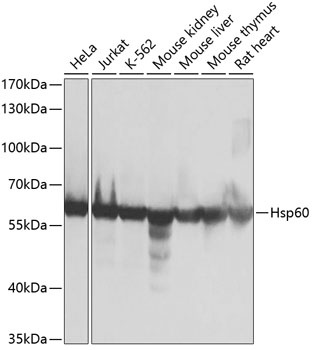 HSPD1 Antibody