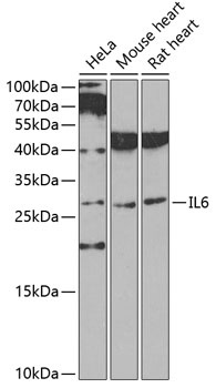 IL6 Antibody