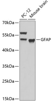 GFAP Antibody