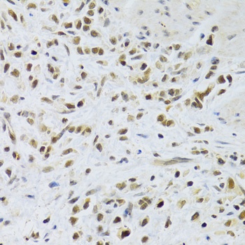 RAD50 Antibody