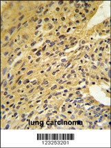 COQ5 Antibody