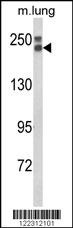 COL18A1 Antibody