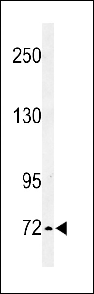 IL1RAPL2 Antibody
