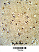 PPID Antibody