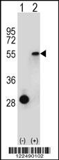 ESRRA Antibody