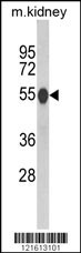 CAT Antibody