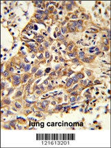 CAT Antibody