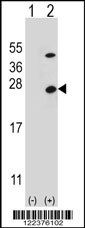 ATP5O Antibody