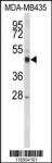 CYP21A2 Antibody