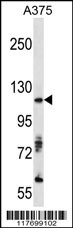 AXL Antibody