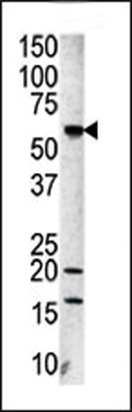 AURKA Antibody
