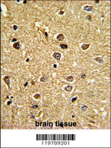 RCBTB2 Antibody