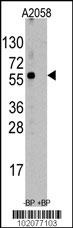 ST13 Antibody