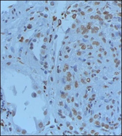 Grem1 Antibody