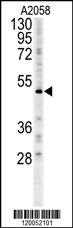 FOXC2 Antibody