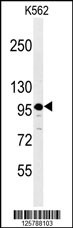 SEZ6L2 Antibody