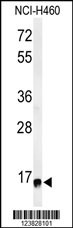 RPS13 Antibody