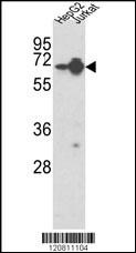 HNRNPL Antibody
