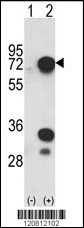 HNRNPL Antibody