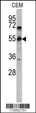 CD36 Antibody
