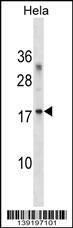 RPL36A Antibody