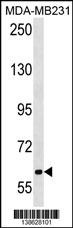 TRPC4AP Antibody