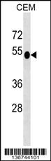 DUSP6 Antibody