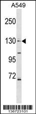 COL4A6 Antibody