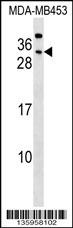 CEACAM7 Antibody