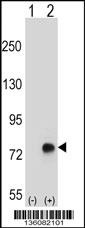 TGFBI Antibody
