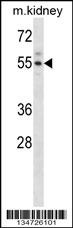 Acvr2a Antibody