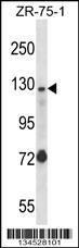 UBE4A Antibody