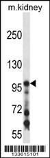 COL1A1 Antibody