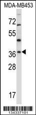 RNF144A Antibody