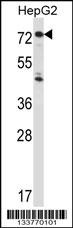 IL1R1 Antibody