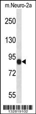CHSY1 Antibody